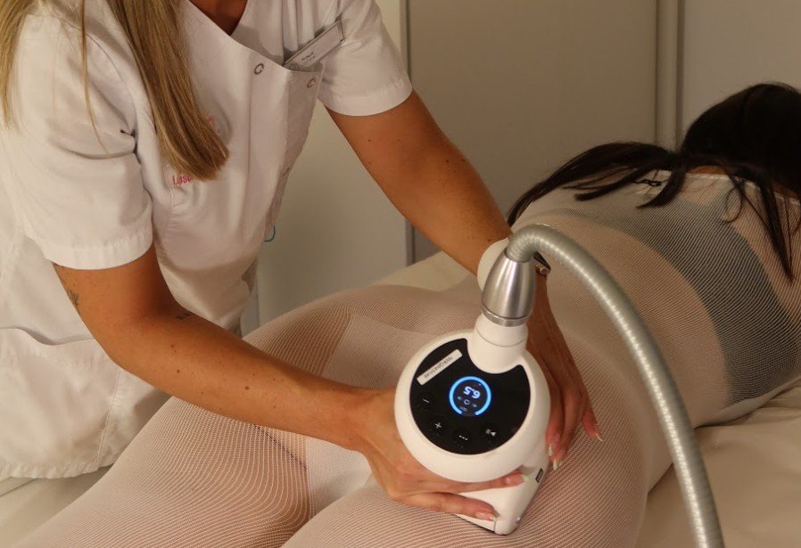 tratamiento remodelacion lpg laser arganda