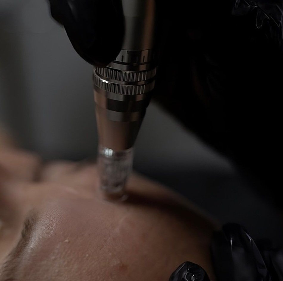 faqs microneedling dermapen