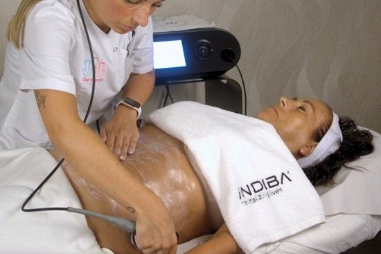 indiba edna pro max tratamiento corporal arganda del rey laser arganda