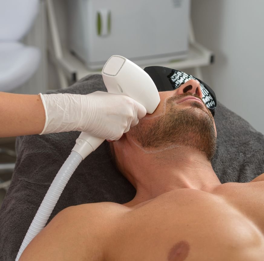 depilacion laser hombre arganda del rey