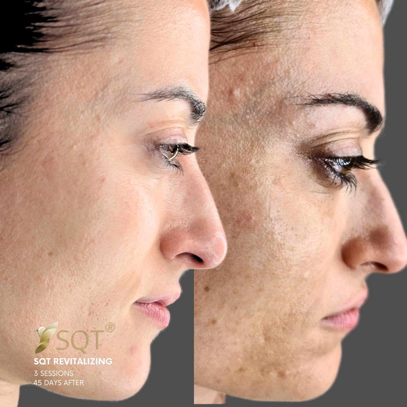 fotos web vertical 15