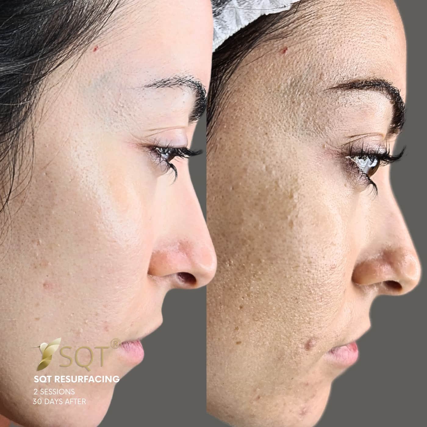 fotos web vertical 16