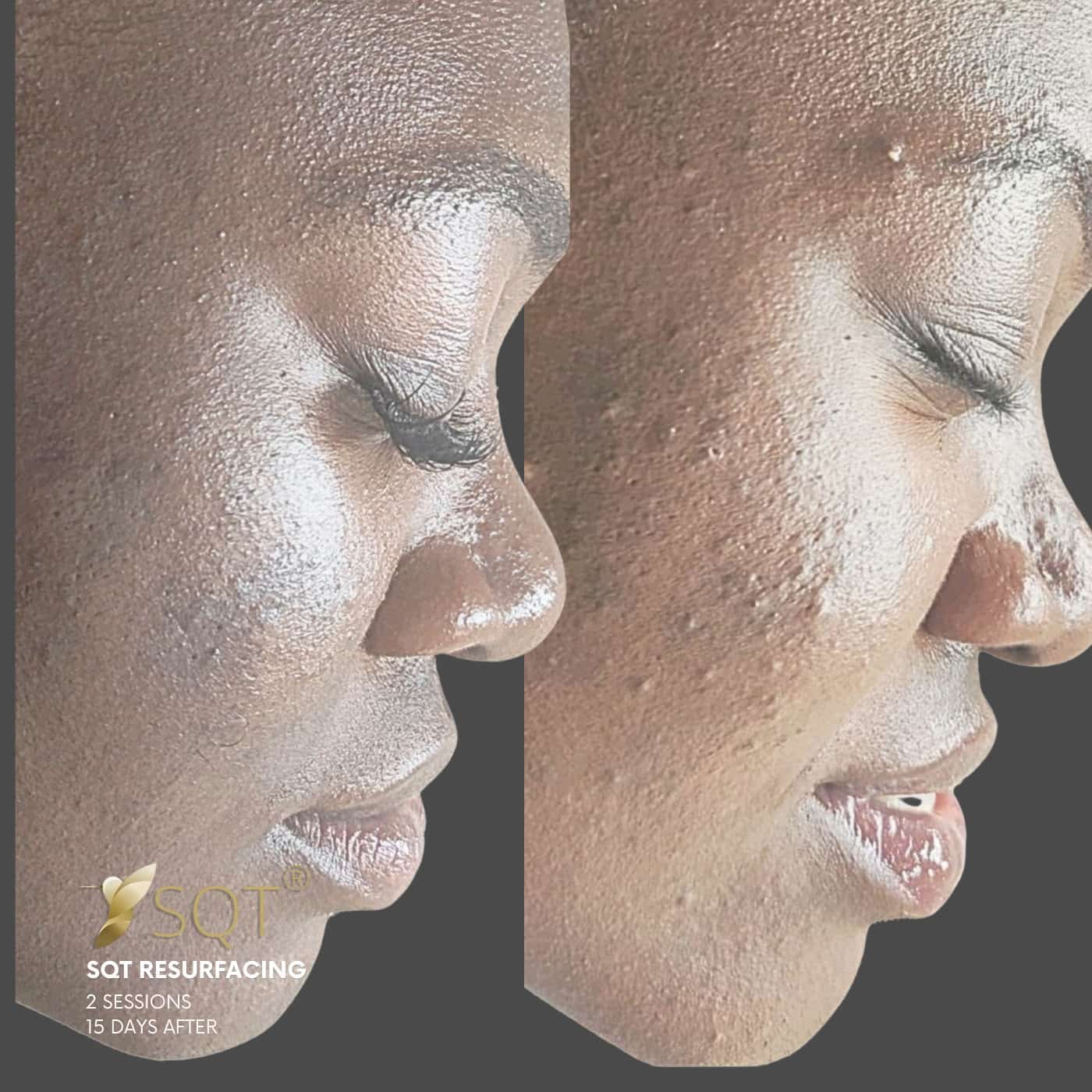 fotos web vertical 17