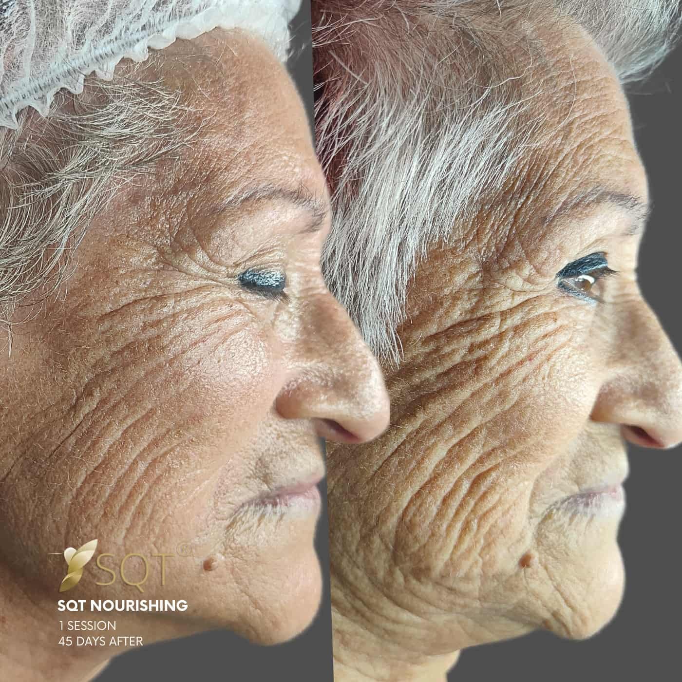 fotos web vertical 18