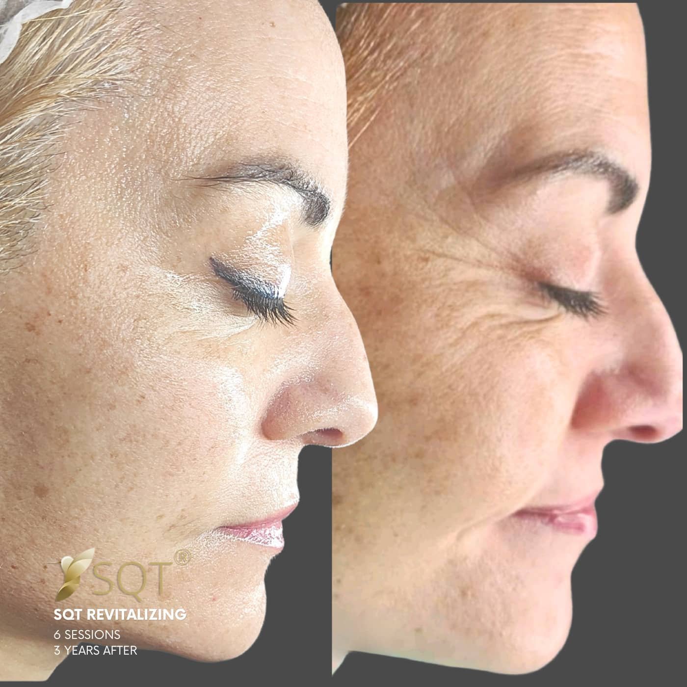 fotos web vertical 19