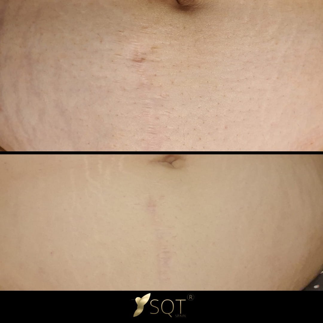 20230818_171835_0000